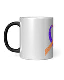 Psoriatic Arthritis Awareness Magic Mug – 11oz Color Changing Ceramic Mug - The Awareness Store