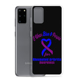 Rheumatoid Arthritis Awareness I Wear Blue & Purple Samsung Phone Case - The Awareness Store